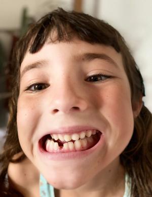 Jade a perdu sa dent jade a perdu sa dent